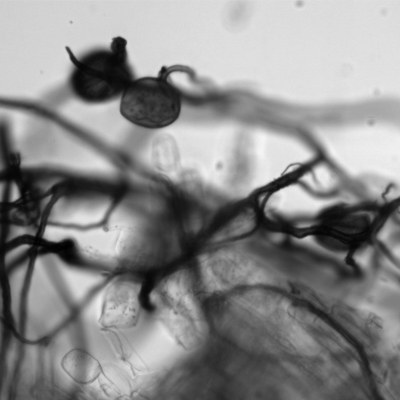 rhizosphere bacteria